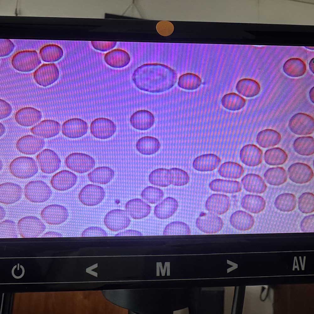 美容と健康・血球チェックとマイナスイオン美容体験